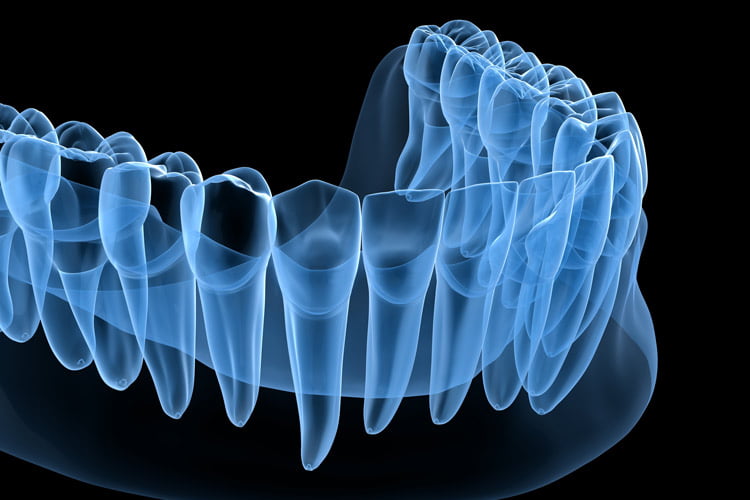 dental x-ray of lower jaw