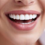 Cosmetic Dentistry