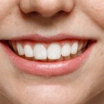 Can tooth enamel be restored
