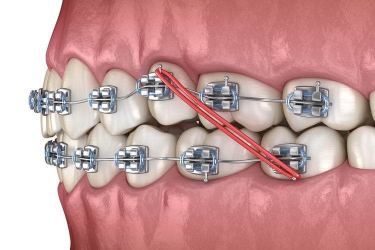 Orthodontics, Family Dentistry, Dental Health Associates