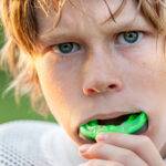 Protect your teeth mouth guards